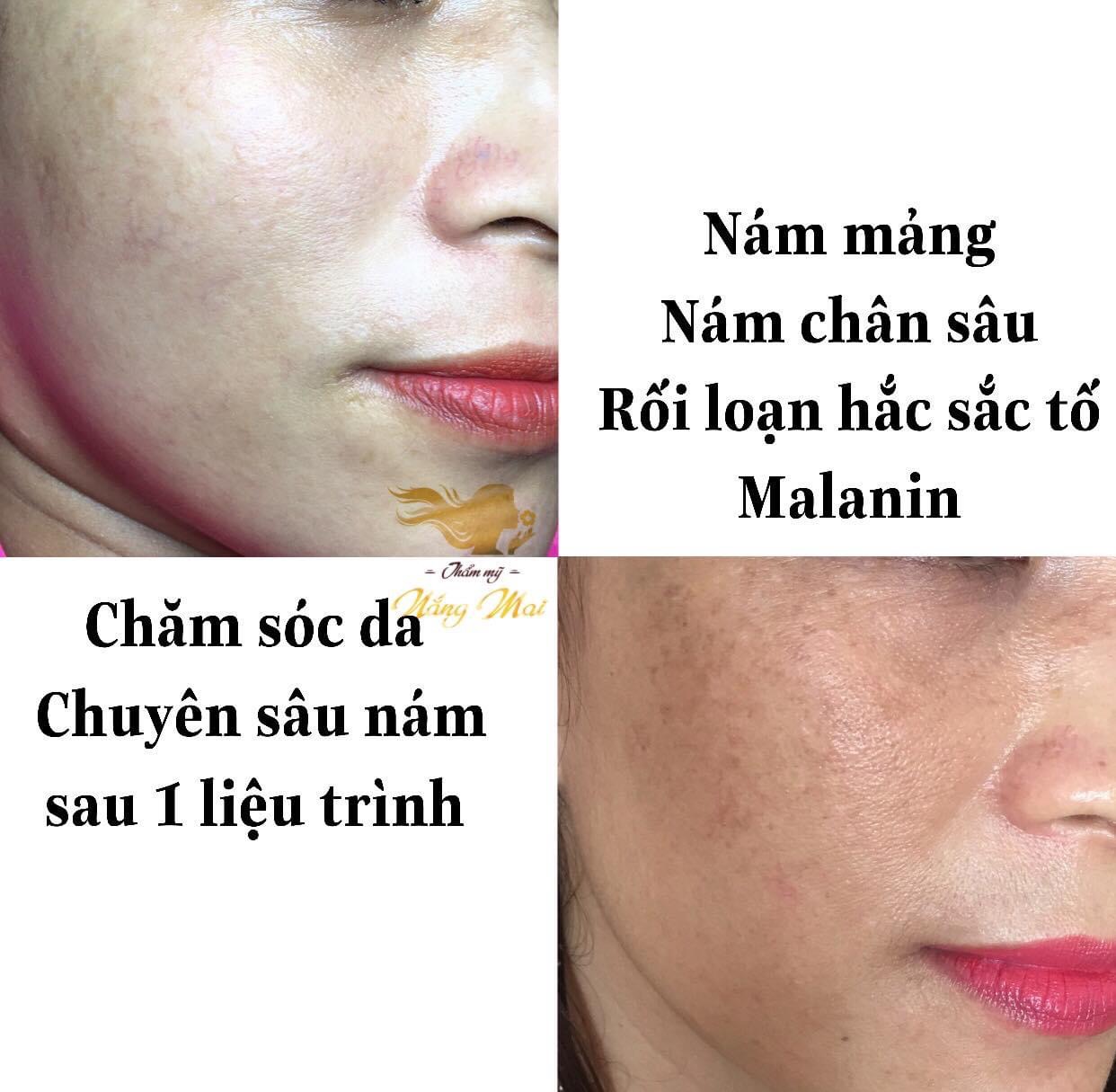 Top 7 Dịch vụ chăm sóc mẹ và bé uy tín, chuyên nghiệp nhất tại TPHCM