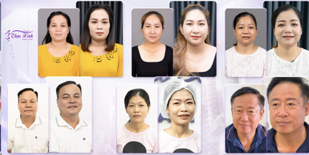 Top 10 Địa chỉ phun xăm thẩm mỹ uy tín và chất lượng nhất TPHCM - Phòng Khám Thẩm Mỹ Thảo Xinh